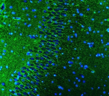 EAAT1 Antibody / Excitatory amino acid transporter 1 / GLAST