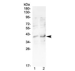 Western blot testing of human 1) Jurkat and 2) MCF7 cell lysate with CCR5 antibody at 0.5ug/ml. Pred