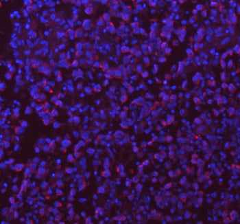 Immunohistochemical staining of SASS6 using anti-SASS6 antibody (red). SASS6 was detected in a paraf