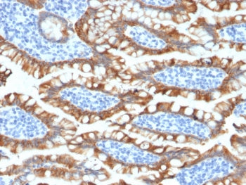 KRT8 Antibody / Cytokeratin 8