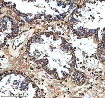 Immunohistochemical staining of MS4A4E using anti-MS4A4E antibody. MS4A4E was detected in a paraffin