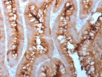 CEA Antibody / Carcinoembryonic Antigen