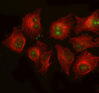 Immunofluorescent staining of S100P using anti-S100P antibody (green) and anti-Beta Tubulin antibody