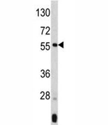 Western blot analysis of ANGPTL3 antibody and mouse liver tissue lysate. Expected molecular weight 5