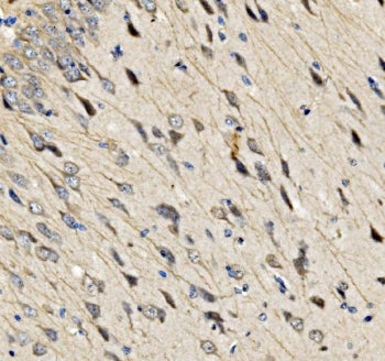 IHC staining of FFPE rat brain tissue with Sur8 antibody. HIER: boil tissue sections in pH8 EDTA for