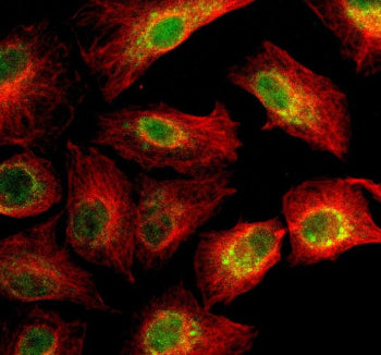 Immunofluorescent staining of SIGLEC15 using anti-SIGLEC15 antibody (green) and anti-Beta Tubulin an