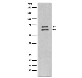 Western blot testing of human HeLa cell lysate with Lamin A/C antibody. Predicted molecular weight ~