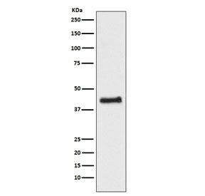 COUP TF1 Antibody / NR2F1
