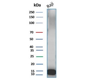 Western blot testing of human Raji cell lysate with Ubiquitin antibody (clone UBB/3143R). Expected m