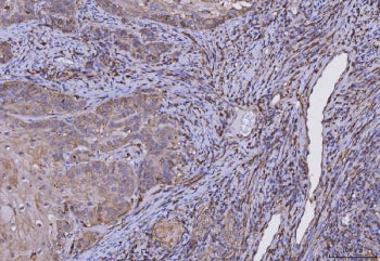 HLA-DRA Antibody
