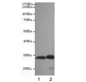 Western blot testing of human 1) HeLa and 2) K562 cell lysates using CDK4 antibody at 1:500. Predict