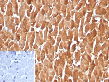 IHC staining of FFPE human heart tissue with PSAP antibody (clone FABP3/3770). Inset: PBS used in pl