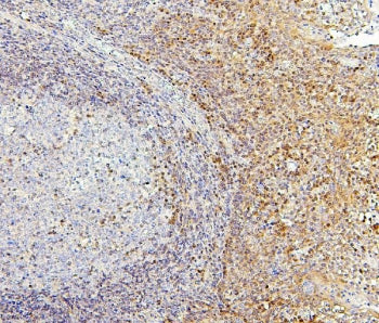 PPCS Antibody / Phosphopantothenoylcysteine synthetase