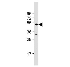 Western blot testing of human K562 cell lysate with MBD2 antibody. Expected molecular weight ~47 kDa