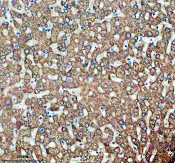 Immunohistochemical staining of TIRAP using anti-TIRAP antibody. TIRAP was detected in a paraffin-em