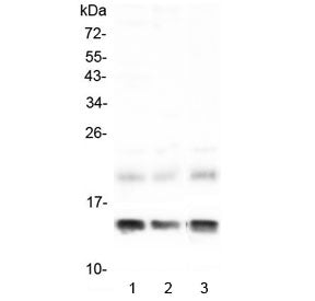 FABP1 Antibody (liver)