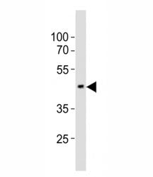 EED Antibody