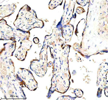 Immunohistochemical staining of HAPLN1 using anti-HAPLN1 antibody. HAPLN1 was detected in a paraffin