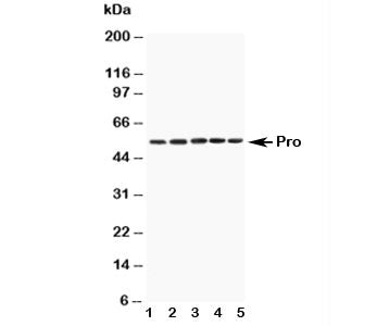 Western blot testing of Caspase-8 antibody and mouse samples: 1. Spleen, 2. Thymus, 3. Kidney, 4. Lu