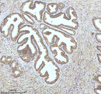 Immunohistochemical staining of IGFL3 using anti-IGFL3 antibody. IGFL3 was detected in a paraffin-em