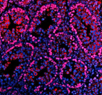 Immunofluorescent staining of PARP11 using anti-PARP11 antibody (red). PARP11 was detected in a para