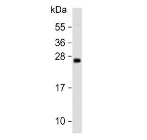 Western blot testing of human PC-3 cell lysate with GADD153 antibody. Expected molecular weight: 19-