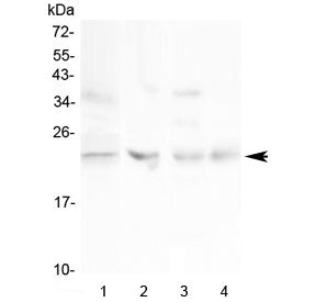 Western blot testing of 1) human HeLa, 2) rat ovary, 3) rat lung and 4) mouse ovary lysate with TIMP