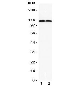 DOG1 Antibody (TMEM16A)