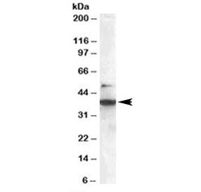 Western blot testing of Jurkat lysate with SH3GLB1 antibody at 0.3ug/ml. The expected ~38 kDa and ad
