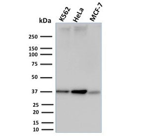Western blot testing of human K562, HeLa and MCF-7 cell lysate with RAD51 antibody. Expected molecul
