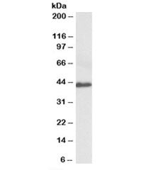Western blot testing of human colorectal cancer lysate with Fractalkine antibody at 0.3ug/ml. Predic