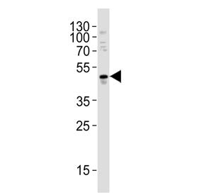 Western blot testing of human A549 cell lysate with MMP10 antibody. Predicted molecular weight ~54 k