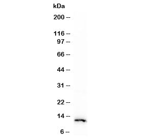 Western blot testing of human HeLa cell lysate with recombinant S100A4 antibody (clone PS1A4-1R). Pr