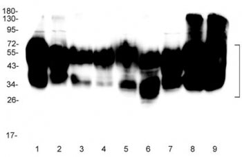 CD147 / Emmprin / Basigin Antibody