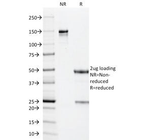 SDS-PAGE analysis of purified, BSA-free PP65 antibody (clone CMV101) as confirmation of integrity an