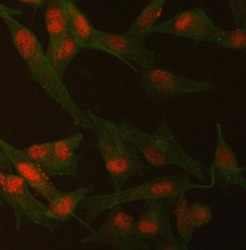 Immunofluorescent staining of FFPE human U-87 MG cells with SMCHD1 antibody (red) and Beta Tubulin m