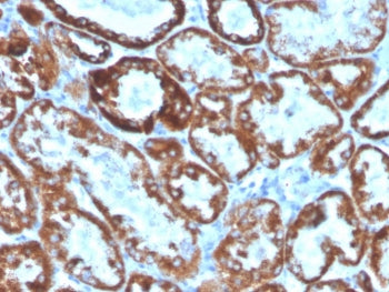 CD137L Antibody / 4-1BBL / TNFSF9