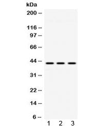 ACAA2 Antibody