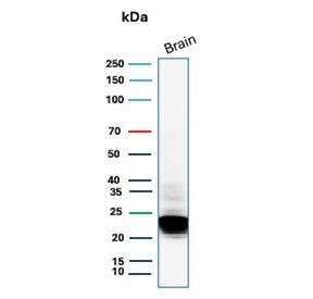 Western blot testing of human brain tissue with recombinant MBP antibody. Expected molecular weight: