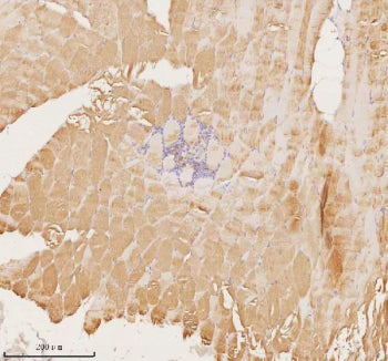 Immunohistochemical staining of MAP4K3 using anti-MAP4K3 antibody. MAP4K3 was detected in a paraffin