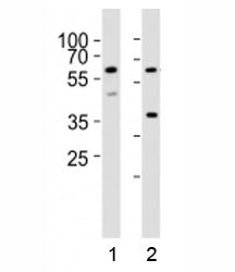 Western blot analysis of lysate from 1) HT-29 and 2) K562 cell lines using RIPK3 antibody at 1:1000.