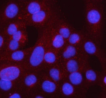 IF analysis of Syncoilin/SYNC using anti-SYNC antibody (red). SYNC was detected in an immunocytochem