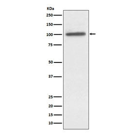 ACTN4 Antibody / Alpha Actinin 4