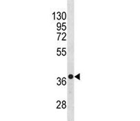 CXCR4 Antibody, 0.08ml