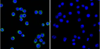 Lambda Light Chain Antibody / Lambda Antibody