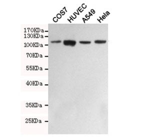 Western blot testing of monkey COS7, human HUVEC, human A549 and human HeLa cell lysates with FAK an
