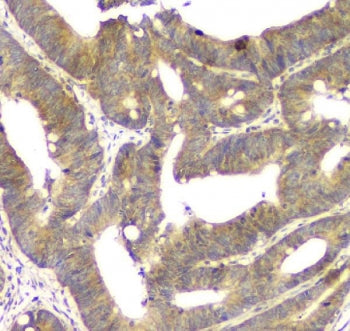 ALKBH1 Antibody