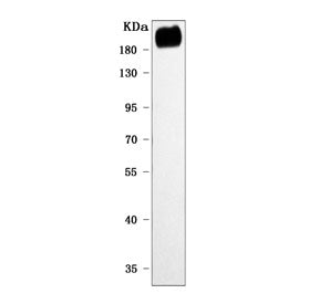 Western blot testing of mouse skeletal muscle tissue with PREX2 antibody. Predicted molecular weight