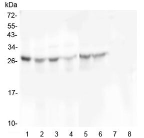 Western blot testing of 1) human placenta, 2) human U-87 MG, 3) monkey COS-7, 4) human U-2 OS, 5) hu