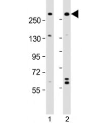 Western blot testing of human 1) A431 and 2) U-2OS cell lysate with NBAS antibody at 1:2000. Predict